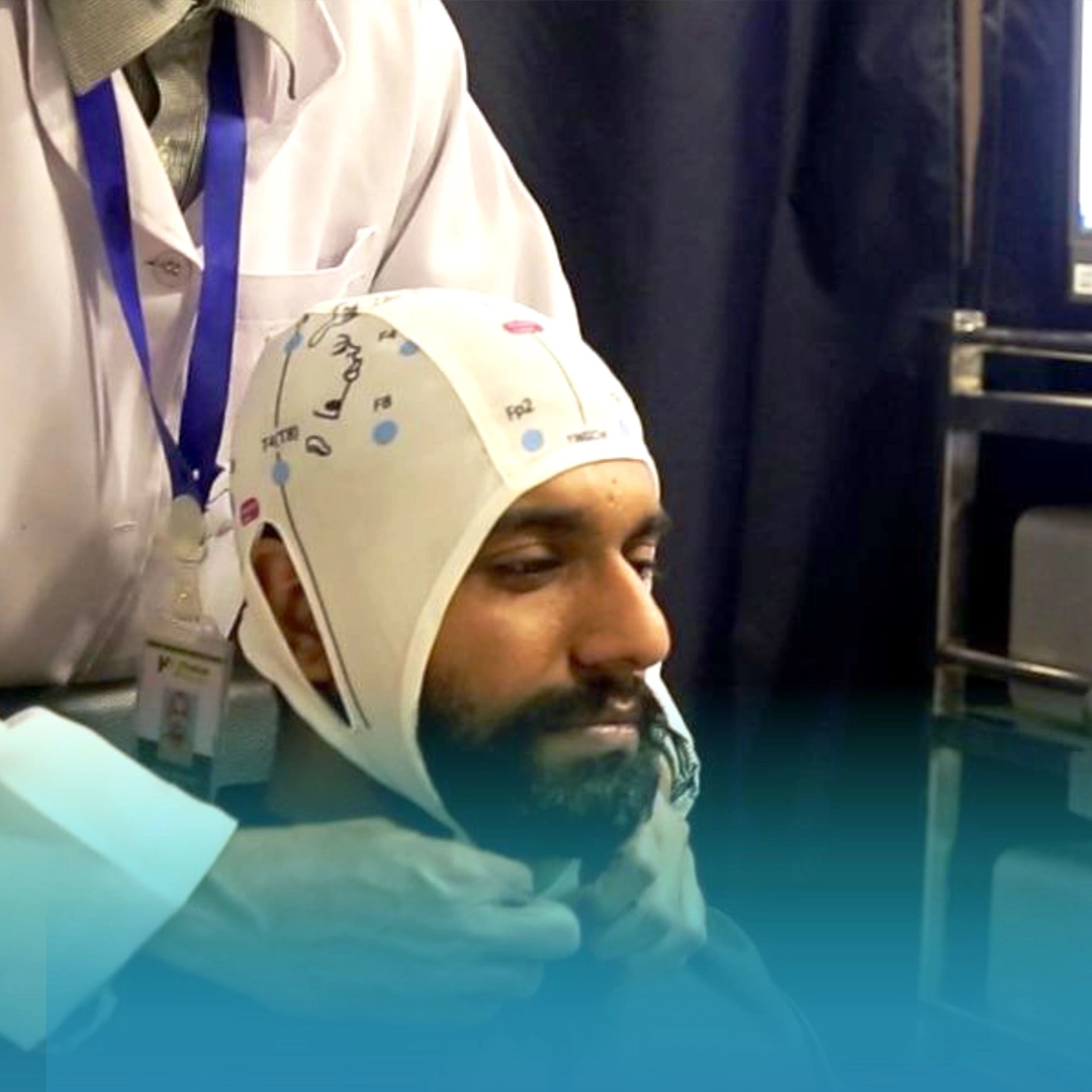 transcranial magnetic stimulation (tms)